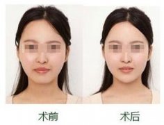 诚聘英才 第230页