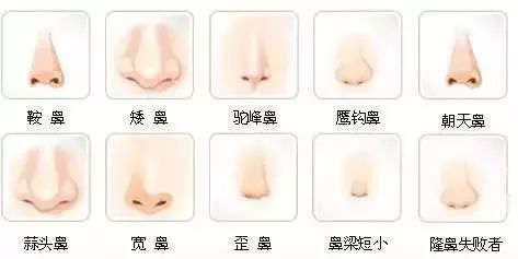 鼻型重塑艺术